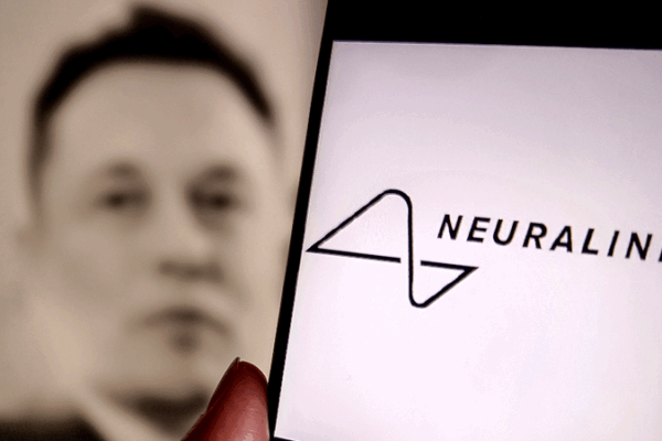 Neuralink का N1 इम्प्लांट मील का पत्थर: विचार-नियंत्रित तकनीक में एक नई युग Neuralink का N1 इम्प्लांट मील का पत्थर: विचार-नियंत्रित तकनीक में एक नई युग
